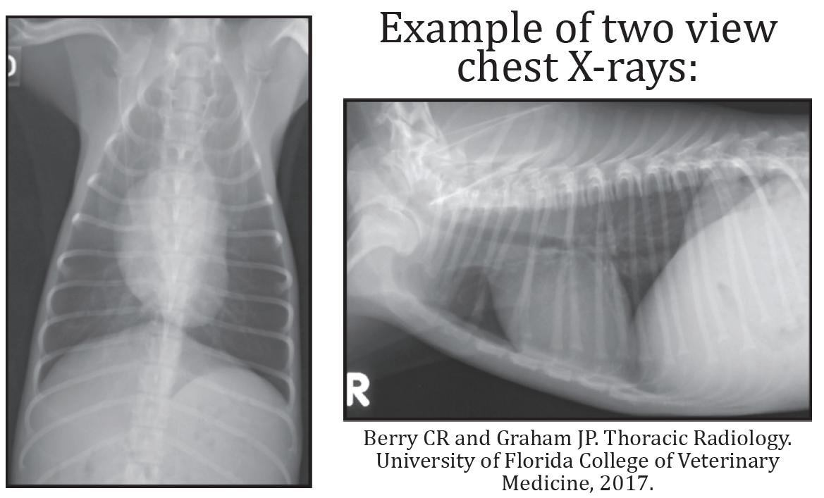 Example of two view chest X-rays