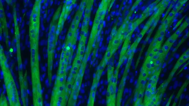 fluorescent microscopy image showing elongated green sarcoma cells with scattered blue-stained nuclei