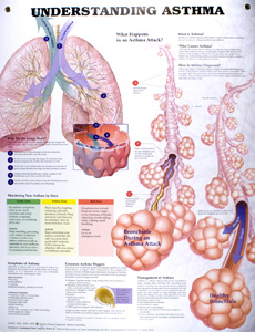 Understanding Asthma Posters