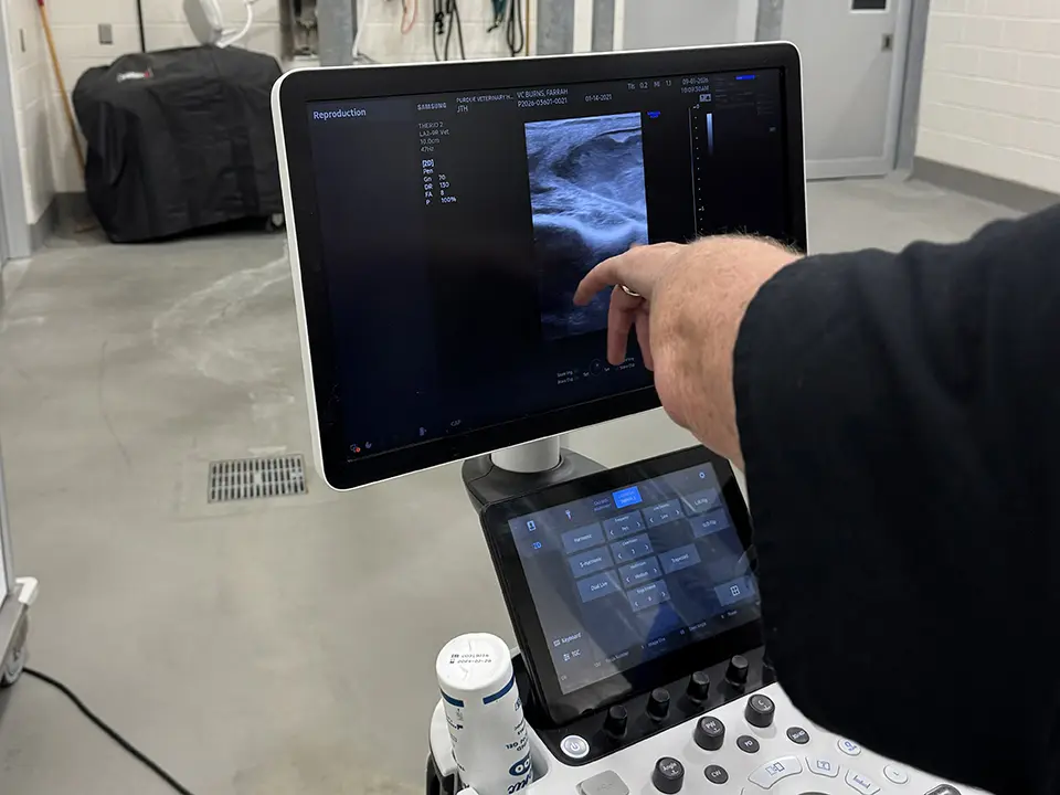 A person points at an ultrasound image displayed on a medical imaging monitor.
