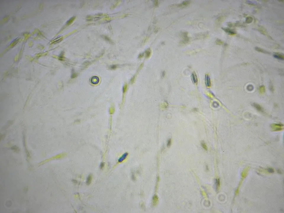 Microscopic view of semen in a fluid sample.