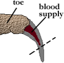 illustration of where to cut nails