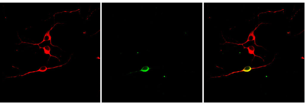 brain cell culture pictured