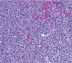 histopathologic section