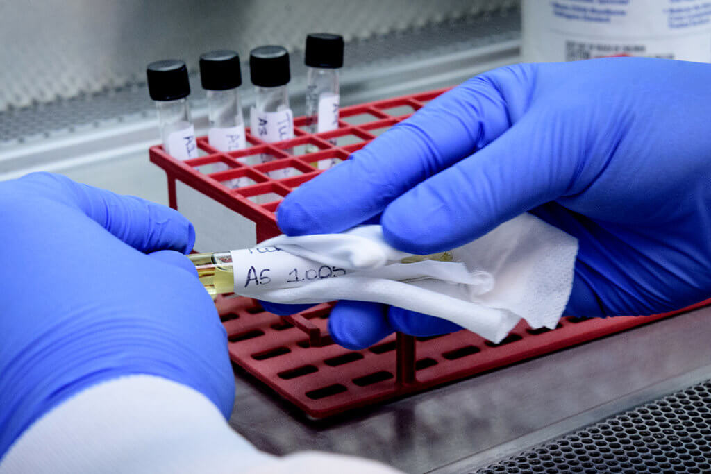 Gloved hands disinfect a sample tube with other sample tubes in a stand in the background