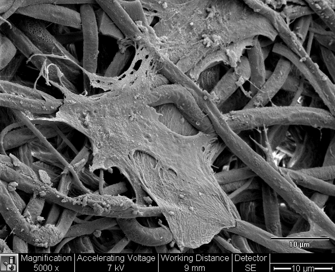 a black and white micrograph image magnified 5000x