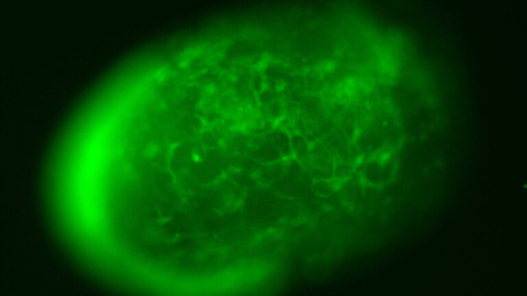A live image of vascularized neuroimmune organoids. The green signal highlights the vascular structures within the mini brain.